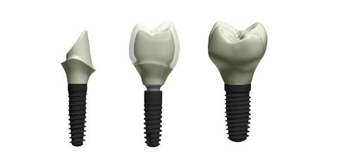 Zirconia Milling